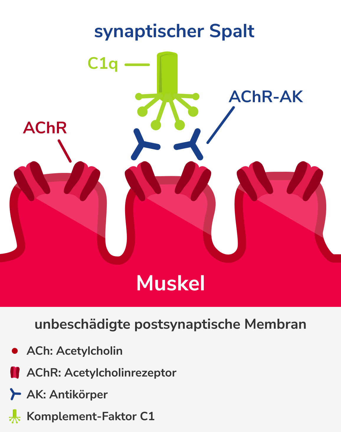 Pathophysiologische Wirkung der AChR-Antikörper, Grafik 3