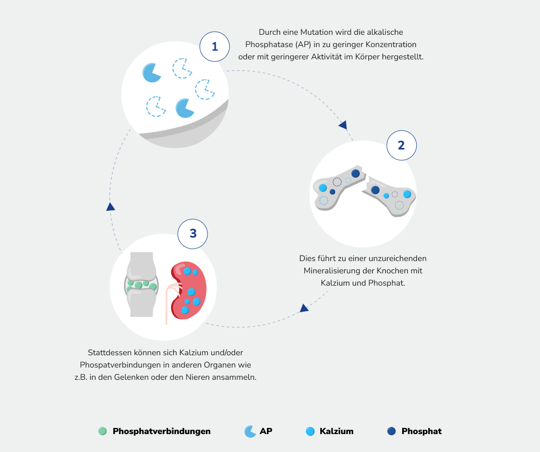 Durch eine Mutation wird die alkalische Phosphatase in zu geringer Konzentration hergestellt. Dies führt zu einer unzureichenden Mineralisierung der Knochen. Stattdessen können sich Kalzium und oder Phosphatverbindungen in anderen Organen ansammeln.