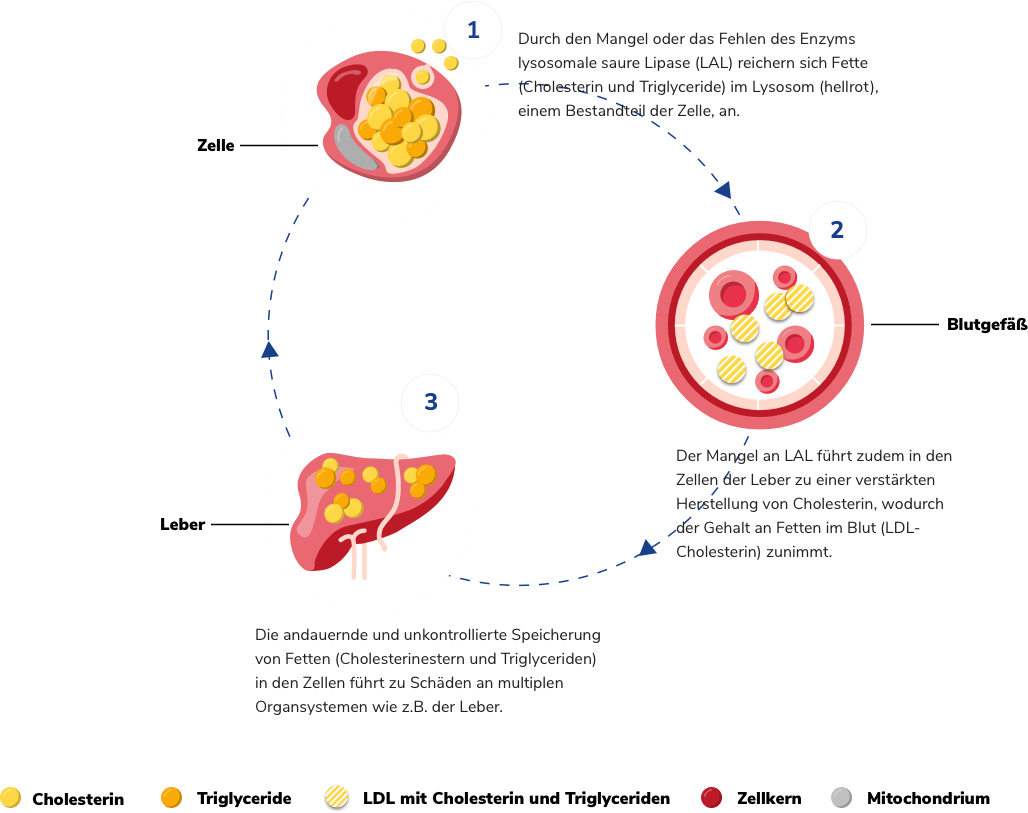 Im Lysosom reichern sich Fette an. In den Leberzellen führt der Mangel an LAL zur verstärkten Herstellung von Cholesterin. Dauerhaft führt dies zu Schäden an multiplen Organsystemen.