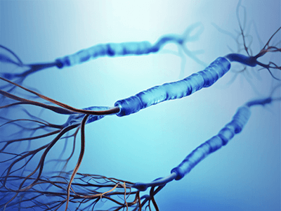 Neurofibromatose Typ 1