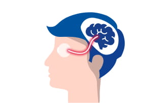 Patient mit entzündetem Sehnerv