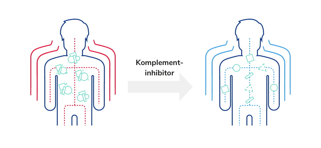 Komplementinhibitoren verhindern die übermäßige Aktivierung des Komplementsystems 