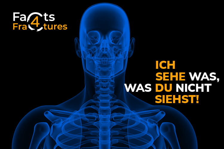 Blaues Skelett mit Logo Facts4Fractures und Schriftzug "Ich sehe was, was du nicht siehst!"