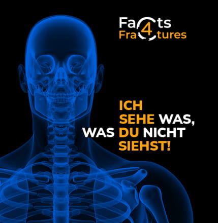 Facts4Fractures Seminar